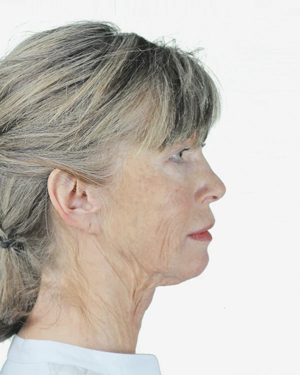 Prima della routine viso - contorno viso e collo