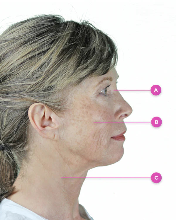 Dopo la routine viso - contorno viso e collo
